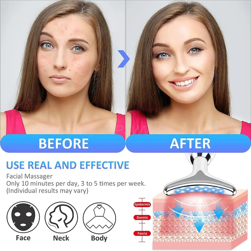 Zylo - Premium Face Massage & Skin Tightening Tool